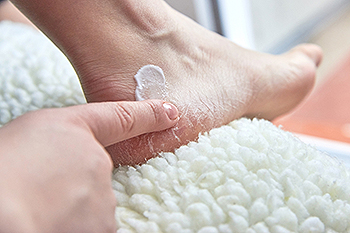 Feet cracking deals and splitting