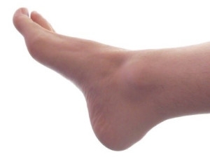 What Can Cause Stress Fractures?