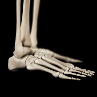 Reasons That Stress Fractures Can Develop